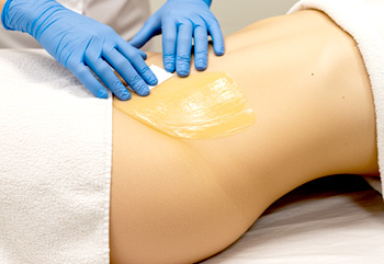 ③ WAX（ワックス）脱毛